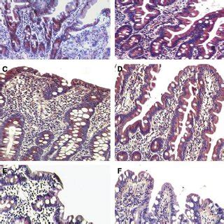 Divalent Metal Transporter Dmt Duodenal Cytochrome B Dcytb