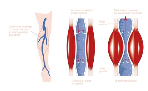 L Insuffisance Veineuse Chronique Ou I V C Tudiant Podologie