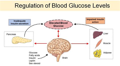 Diabetes And Metabolism UW Diabetes Institute