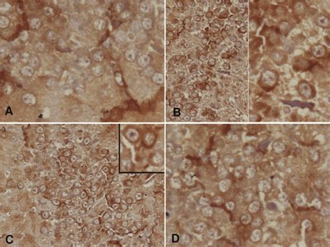 A photomicrograph of sections of the hippocampus stained... | Download ... 