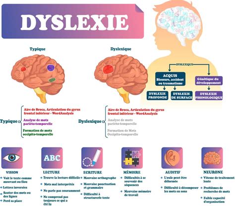 Dyslexie Causes Sympt Mes Et Traitements Information Hospitali Re