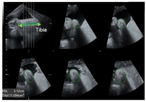 Diagnostics Free Full Text Improving Prenatal Diagnosis Precision