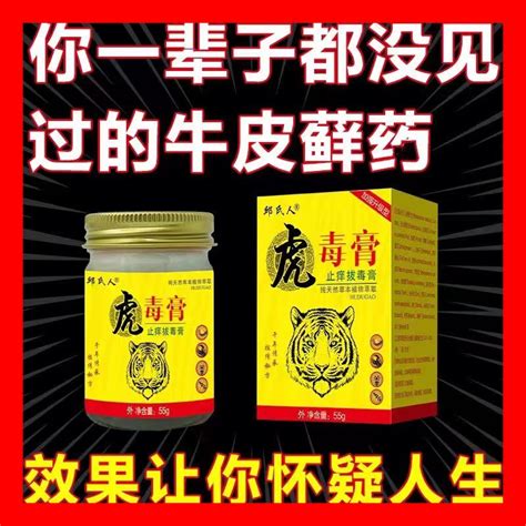 治疗牛皮廯藓银屑病止痒抑菌皮肤瘙痒湿疹去根股体癣特效祛癣药膏 淘宝网