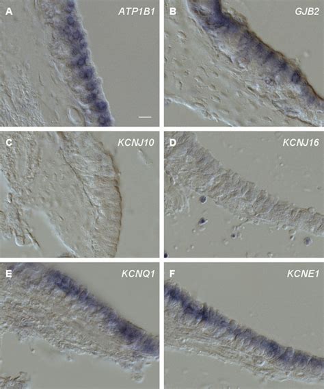 RNA In Situ Hybridization Of Probes On Cross Sections Of The Crista