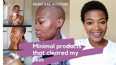 Minimal Products I Used To Clear My Acne South African Youtuber Skincare Skincareproducts