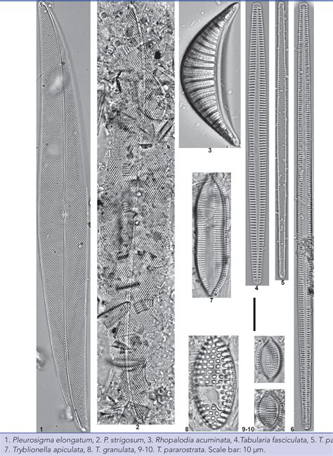 Figure 2 From Benthic Diatom Composition Of Iztuzu Coastal Lake Dalyan