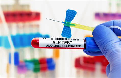 Understanding Alkaline Phosphatase Test: Key Insights & Guidance