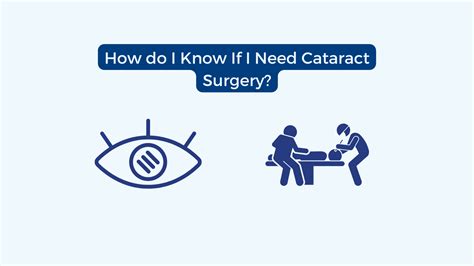 How Do I Know If I Need Cataract Surgery Free State Eye And Laser