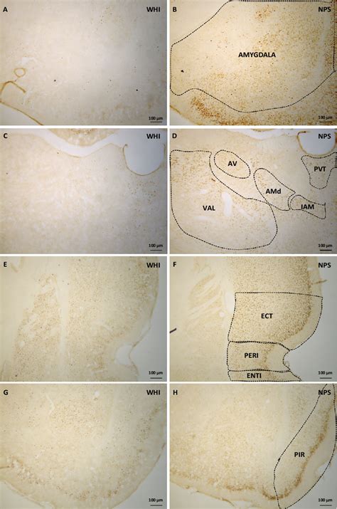 Photomicrograph Of Rat Brain Cross Sections That Have Undergone