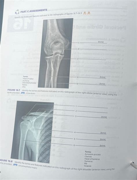 Solved PART C ASSESSMENTSIdentify The Bones And Features Chegg