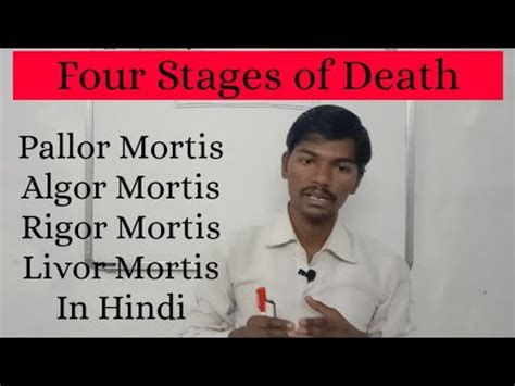 Stages Of Livor Mortis