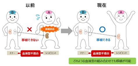 よくわかる基礎知識｜abo血液型不適合移植（腎移植） 家族と考える慢性腎臓病サイト 腎援隊