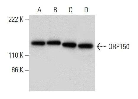 ORP150 Antibody (A-3) | SCBT - Santa Cruz Biotechnology