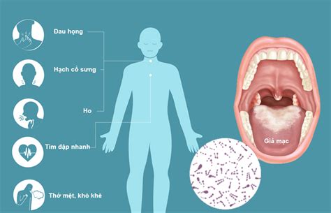 Triệu chứng bệnh bạch hầu ở trẻ em và người lớn