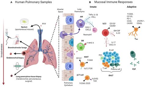 Frontiers Local Pulmonary Immunological Biomarkers In Tuberculosis