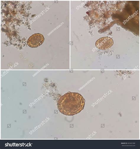 Ascaris Lumbricoides Ova