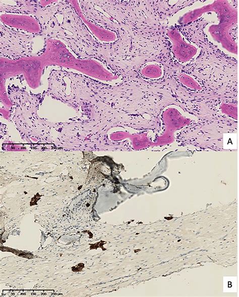 Pathological Anatomy A Hematoxylin And Eosin Staining B Cell