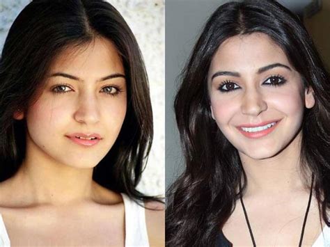 Anushka Sharma Angry Lips Plastic Surgery Lip Job Filmibeat