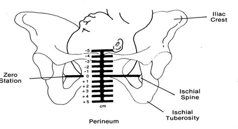 Stations Of Engaged Head Of Baby In Pelvis Childbirth Natural Child