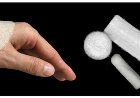 Understanding Eschar Skin Causes Symptoms And Treatment