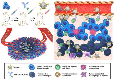 Nanoparticles Click Immune Cells To Make A Deeper Penetration Into Tumors