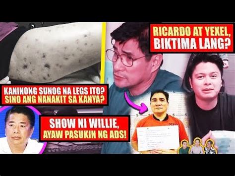 Sinunog Ang Legs Bakit Willie Tuloy Pa Ba Ang Show Ricardo Kulong