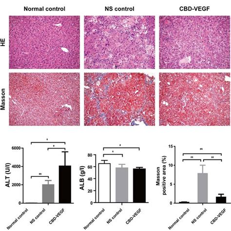 CBD VEGF Alleviated CCl 4 Induced Liver Inflammation And Fibrosis