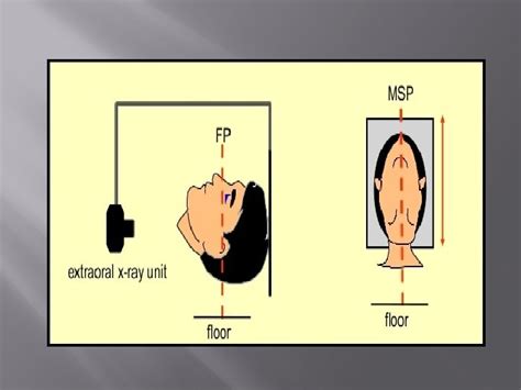 Extraoral Radiographic Technique Extraoral Radiograph Is Defined As