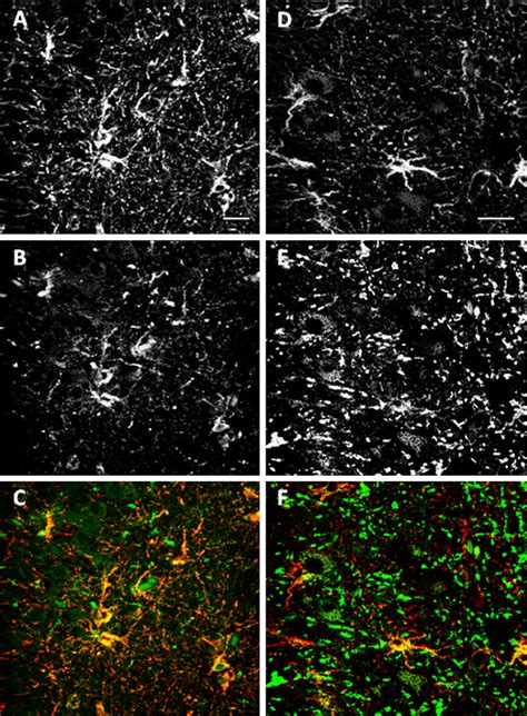 Immunofluorescencedouble Staining Hk And Gfap This Figure Shows