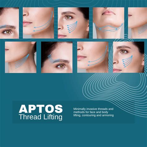 Aptos Cyprus Dermatology Clinic