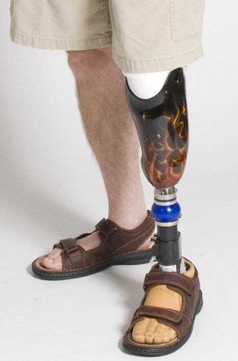 Below Knee Prosthesis Artofit