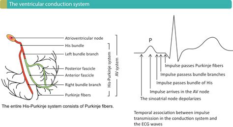 Overview Of Atrioventricular Av Blocks Cardiovascular Education