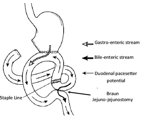 The Uncut Roux En Y Gastro Jejunostomy Download Scientific Diagram