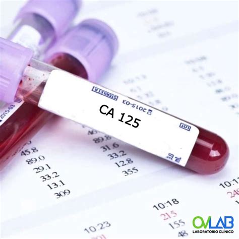 BETA-2 MICROGLOBULINA SÉRICA – OVLAB – O&V Laboratorios