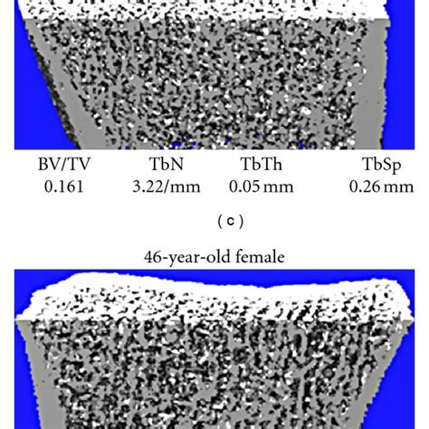 Representative Reconstructions Of High Resolution Peripheral