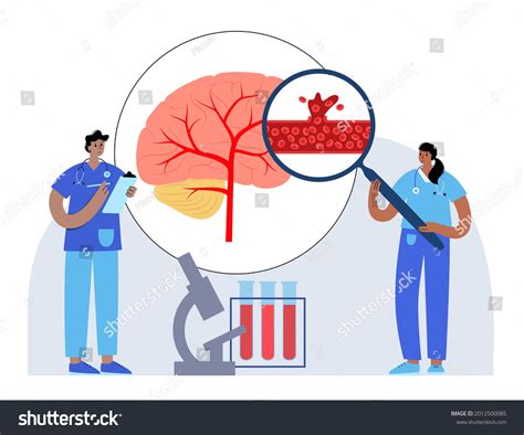 Hemorrhagic Brain Stroke Concept Apoplexy Cerebral Stock Vector