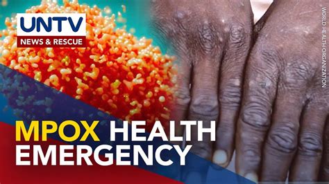 Mpox Outbreak Idineklara Nang Public Health Emergency Ng Africa CDC