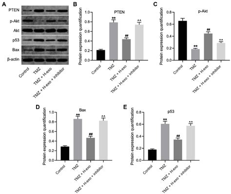 Exosomes Derived From Hypoxic Glioma Cells Reduced Tmz Sensitivity In