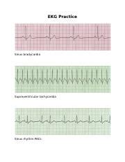 Ekg Practice Strips Printable With Answers