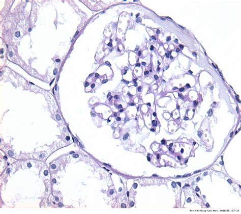 Glomerular Basement Membrane Histology