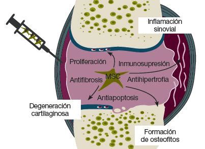 Células madre mesenquimales en ortopedia y traumatología