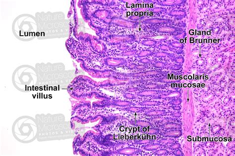 Duodenum Histology Intestinal Gland