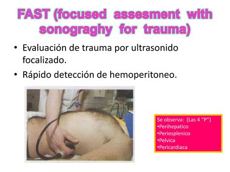 Traumatismo Abdominal En Urgencias M Dico Quir Rgicas Ppt