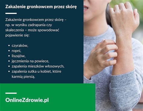 Gronkowiec objawy zakażenia leczenie rodzaje gronkowców