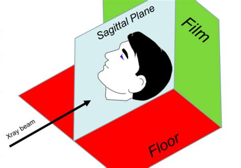 Radiology Extraoral Radiography Techniques Flashcards Quizlet