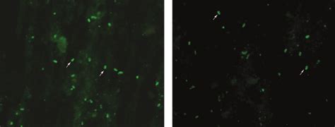 E Bieneusi Spores Excreted By Experimentally Infected Rodents