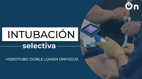 Intubaci N Selectiva Con Videotubo Doble Lumen Youtube