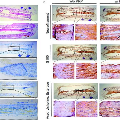 Histologic Evaluation And Immunohistochemistry Analysis Of Regenerated