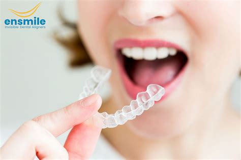 Invisible Aligners For Faster And Effective Dental Healings Evoking Minds