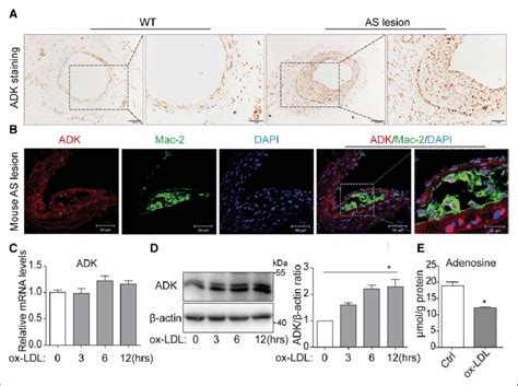 Adk Adenosine Kinase Expression Is Upregulated In Both Aorta Lesions